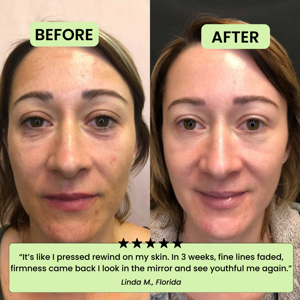 The Korean Toner Pads – Smooth Wrinkles & Restore Your Glow