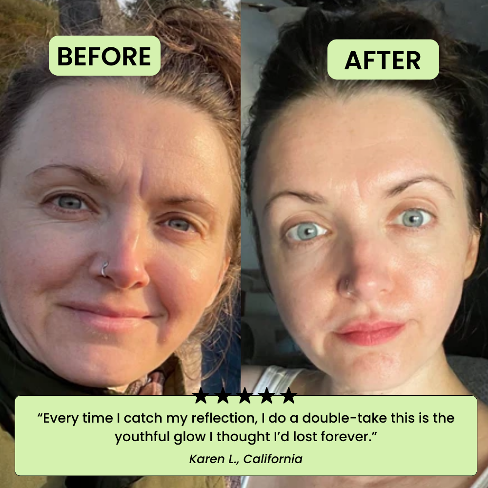 The Korean Toner Pads – Smooth Wrinkles & Restore Your Glow