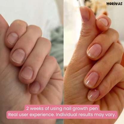 Morivas™ Nail Growth Pen - Grow Strong, Smooth, Beautiful Nails