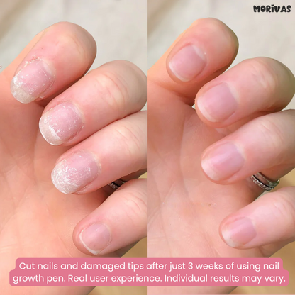 Morivas™ Nail Growth Pen - Grow Strong, Smooth, Beautiful Nails