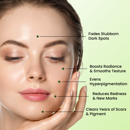 The Korean Toner Pads – Fade Dark Spots & Hyperpigmentation Fast